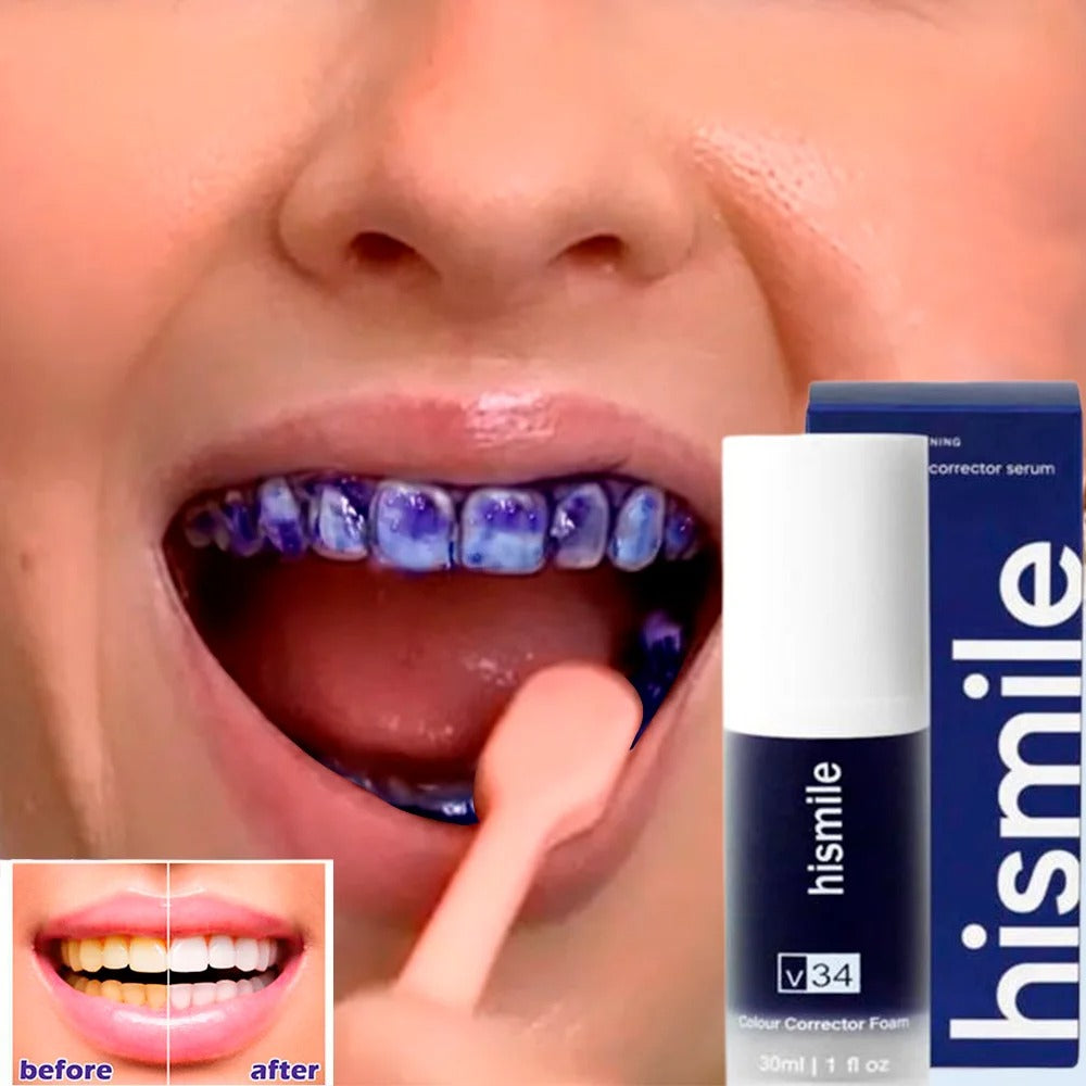Hismile V34 Teeth whitener